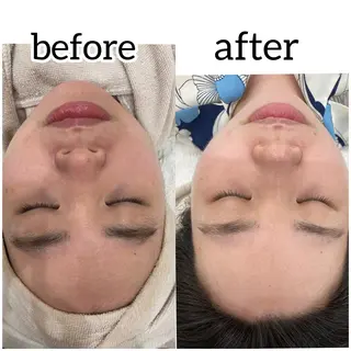 laluna saki...のその他イメージ