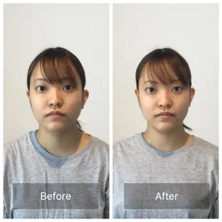 美容整体 小顔矯正 プラスフィール荒木のエステ・リラクイメージ