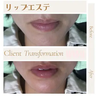 WISH 美肌脱毛のプロ！須藤のエステ・リラクイメージ