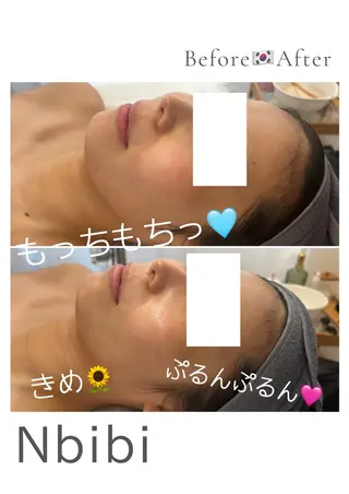 韓国🇰🇷価格 サロン_Nbibiのエステ・リラクイメージ