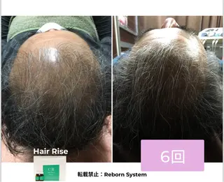 【福岡市西区 エステ】 GRANVIR(グランヴィール)所属・GRANVIR グランヴィールのエステ・リラクイメージ