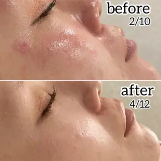 laluna saki...のその他イメージ