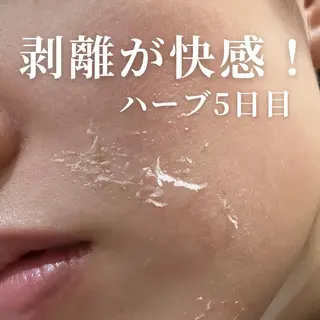 clé skin 🌿ハーブピーリングのエステ・リラクイメージ