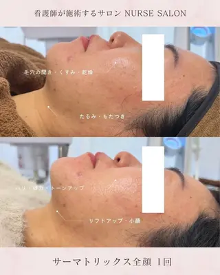 美肌・小顔専門🪄 看護師施術/松﨑のエステ・リラクイメージ
