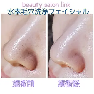 beauty salon  link所属・水素エステと美容脱毛 salon Linkのエステ・リラクイメージ