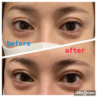 マツエク・マツパ アイラッシュサロン Moa  Moa所属・MoaMoa 🩵ᩚsaya🩵ᩚのマツエク・マツパデザイン