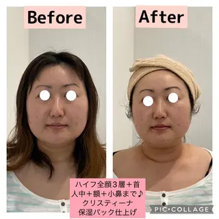 ブライダル痩身×脱毛 尼崎駅前サロンのエステ・リラクイメージ