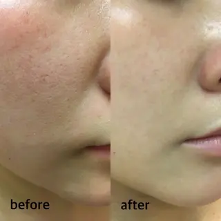 今西 彩夢 Minou心斎橋店のエステ・リラクイメージ