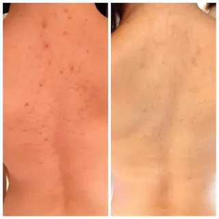 フェイシャル専門 肌質改善/プランスのエステ・リラクイメージ