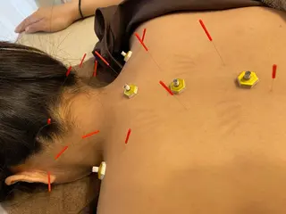 出張鍼灸師 miyuのエステ・リラクイメージ