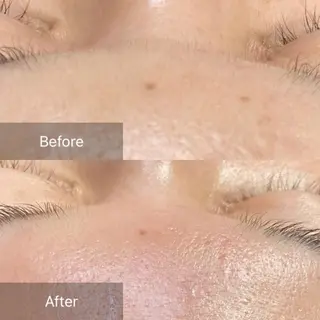 産毛専門店 Bittoのエステ・リラクイメージ