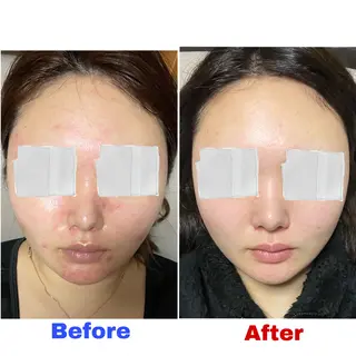 中尾 朱里のエステ・リラクイメージ