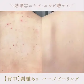 肌質改善サロン renew所属・肌質改善サロン renew/ｳｴｷのエステ・リラクイメージ