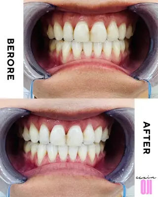 セルフホワイトニングサロン  エクシアホワイト 王寺店所属・エクシア王寺 NISHIKAWAのその他イメージ