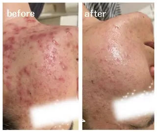 aimee　肌質改善サロン【アイミー】所属・肌質改善サロン aimee｜アイミーのエステ・リラクイメージ