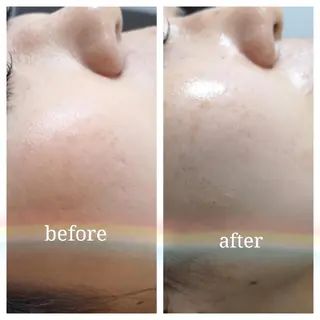 🅖🅤🅩🅔🅛 salonのエステ・リラクイメージ