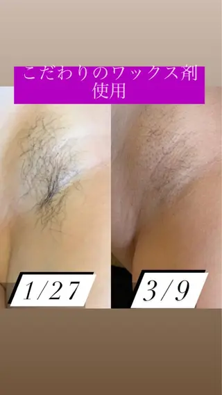 産毛専門店 Bittoのエステ・リラクイメージ