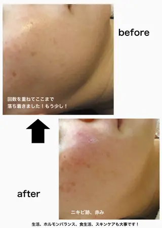 M. lisyelのエステ・リラクイメージ