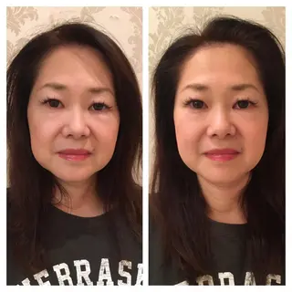 美容鍼サロン    Fleurir所属・伊藤 かなえのエステ・リラクイメージ