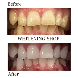 ホワイトニング ショップ銀座7丁目店のその他イメージ