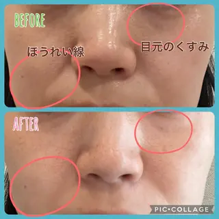 メナードフェイシャルサロン　鏡島精華代行店所属・清水 慎子のその他イメージ