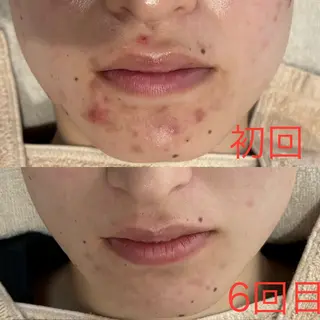 mili mili beauty salon所属・mili mili 岡本のエステ・リラクイメージ