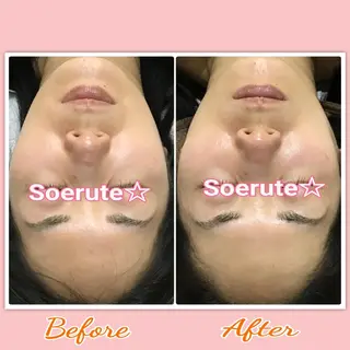 Soerute☆ ソエルテ 井上みえのエステ・リラクイメージ