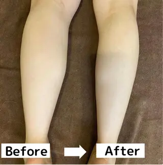 肩首こり×痩身×浄化 🌿リンパエステのエステ・リラクイメージ