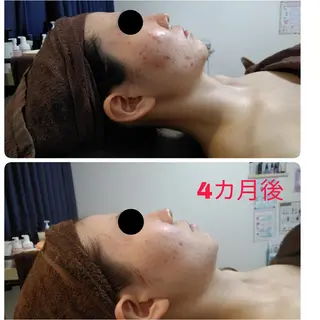 フェイシャルサロン オーガニックロハスのエステ・リラクイメージ