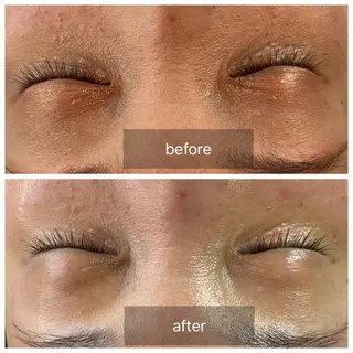 すっぴんたまご肌 平木さやかのエステ・リラクイメージ