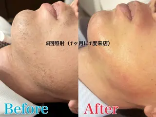 メンズ トータルビューティー サロン Lisseの眉毛・アイブロウイメージ