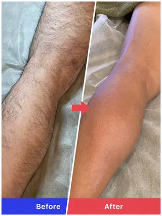 メンズ トータルクリア 田岡のエステ・リラクイメージ