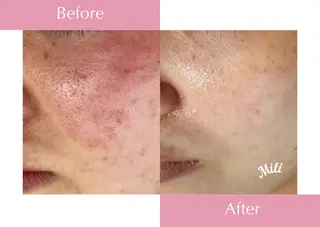 毛穴ケア専門サロン miliのエステ・リラクイメージ