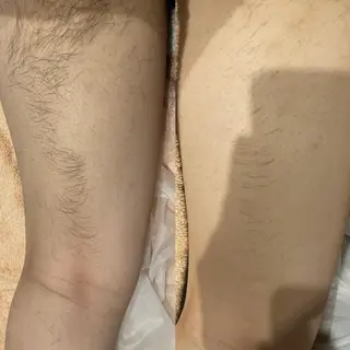 脱毛・眉毛・フェイス サロンN久留米店の眉毛・アイブロウイメージ