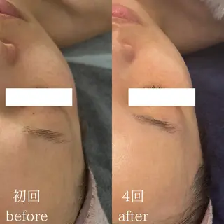 Le cherienのエステ・リラクイメージ