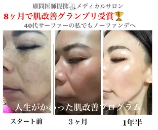 private salon  Dea_maris シュガーリング＆パーソナルボディケア所属・シミ改善・韓国肌管理 ボディメイク痩身のその他イメージ