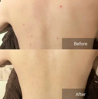 for woman所属・森 美優のエステ・リラクイメージ