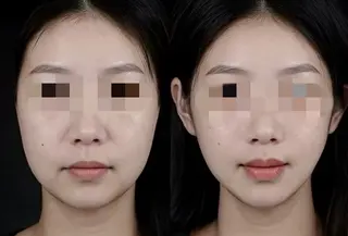 マツエク・マツパ aliaハイフ&水光ジェットサロン所属・aliaハーブ水光店 エステティシャン募集のエステ・リラクイメージ