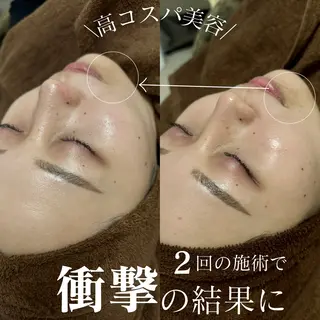 美肌salon GRAN CUORE所属・Natsuki🌙 GRAN CUOREのエステ・リラクイメージ