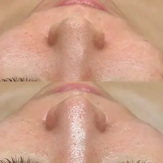 韓国🇰🇷価格 サロン_Nbibiのエステ・リラクイメージ