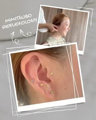 mimine エメラルド式耳つぼのその他イメージ