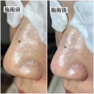 マツヤニWax専門/ 岸和田/Luanaのエステ・リラクイメージ