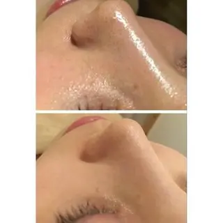 触れたくなる モテ肌へ...❤︎のエステ・リラクイメージ