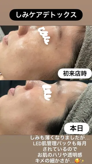 LiZA エステティックサロンのエステ・リラクイメージ