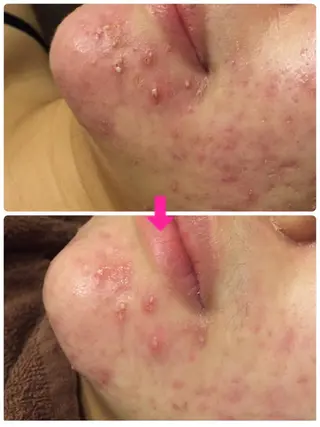 ショート カラー パーマ ヘアアレンジ メンズ キッズ ネイル マツエク・マツパ ‍痩身＆ボディ 結果出し🌟丹野のエステ・リラクイメージ