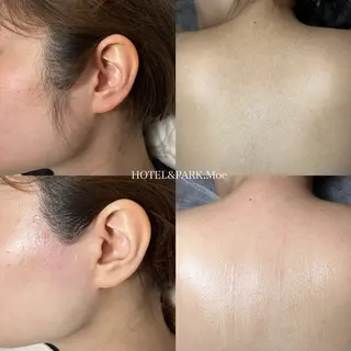 HOTEL&PARK .Moeワックス脱毛のエステ・リラクイメージ