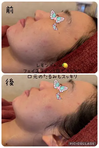 y.laBelle所属・y.laBelle 艶肌・小顔・肌質改善のエステ・リラクイメージ