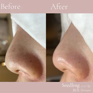 シードリン 府内店 小波のエステ・リラクイメージ