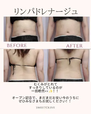 トータルビューティーサロンSweet Olive所属・SweetOlive  Akaneのエステ・リラクイメージ