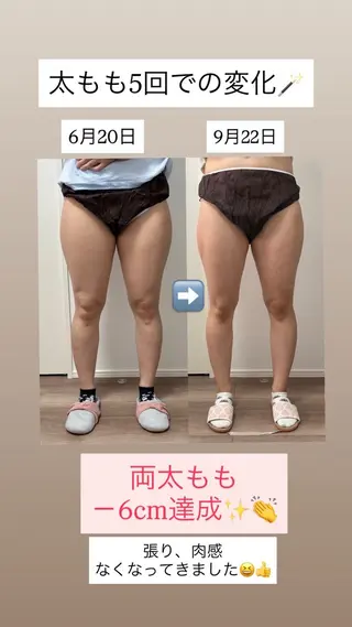 Miiju.所属・Miiju. 石巻市 脂肪冷却  鈴木のエステ・リラクイメージ